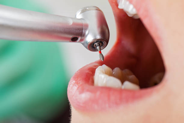 Best Cosmetic Emergency Dentistry in Jackson, WY